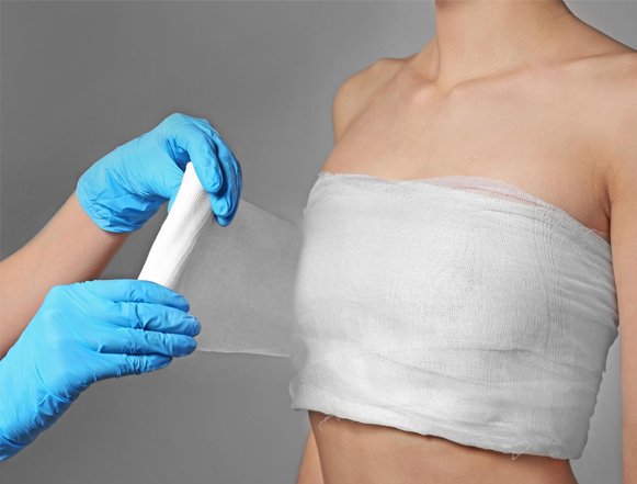 Preparing for Surgery